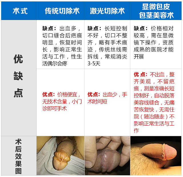 1489212499213179.jpg 1488619010747677.jpg