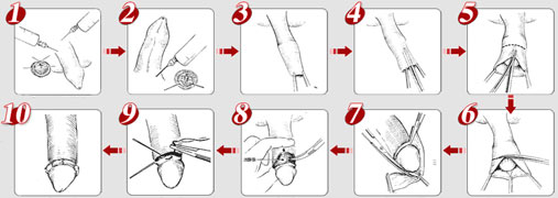 1488619245921783.jpg 1488611301111805.jpg