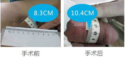 1467611482796087.png blob.png