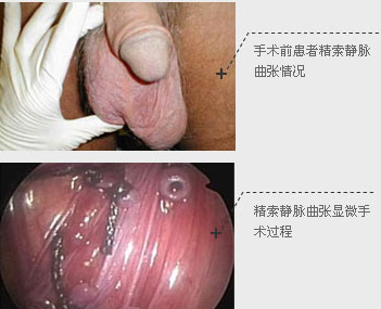 1467098740558896.png blob.png