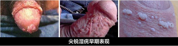 1483172206370804.png blob.png