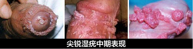 1483172218120480.png blob.png