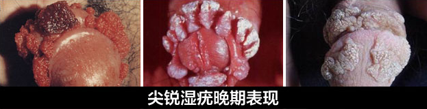 1483172226230090.png blob.png