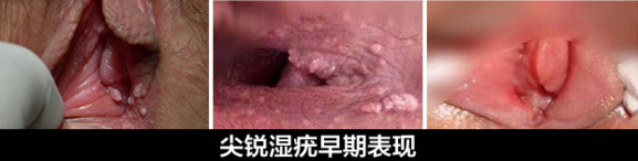 1483172235138433.png blob.png