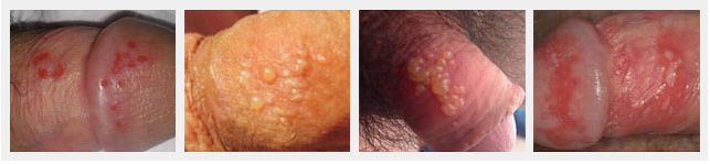 1483172542523739.png blob.png