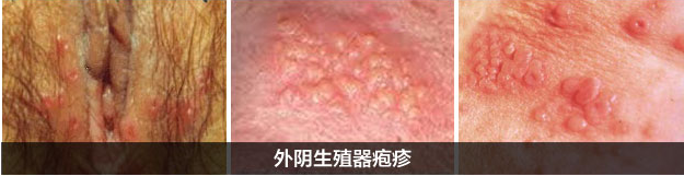 1483172551331602.png blob.png